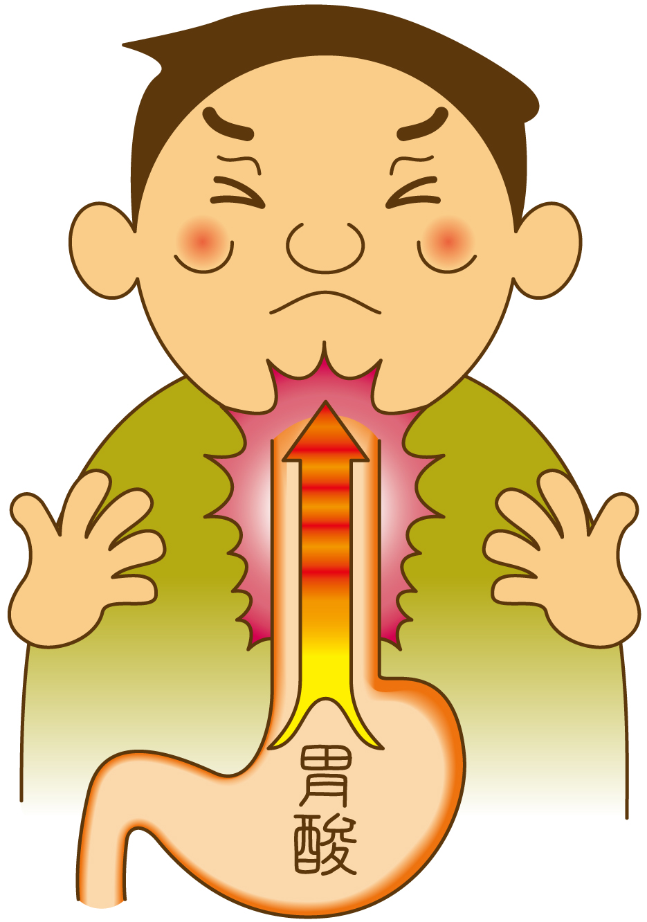 胸やけ症状はありませんか？