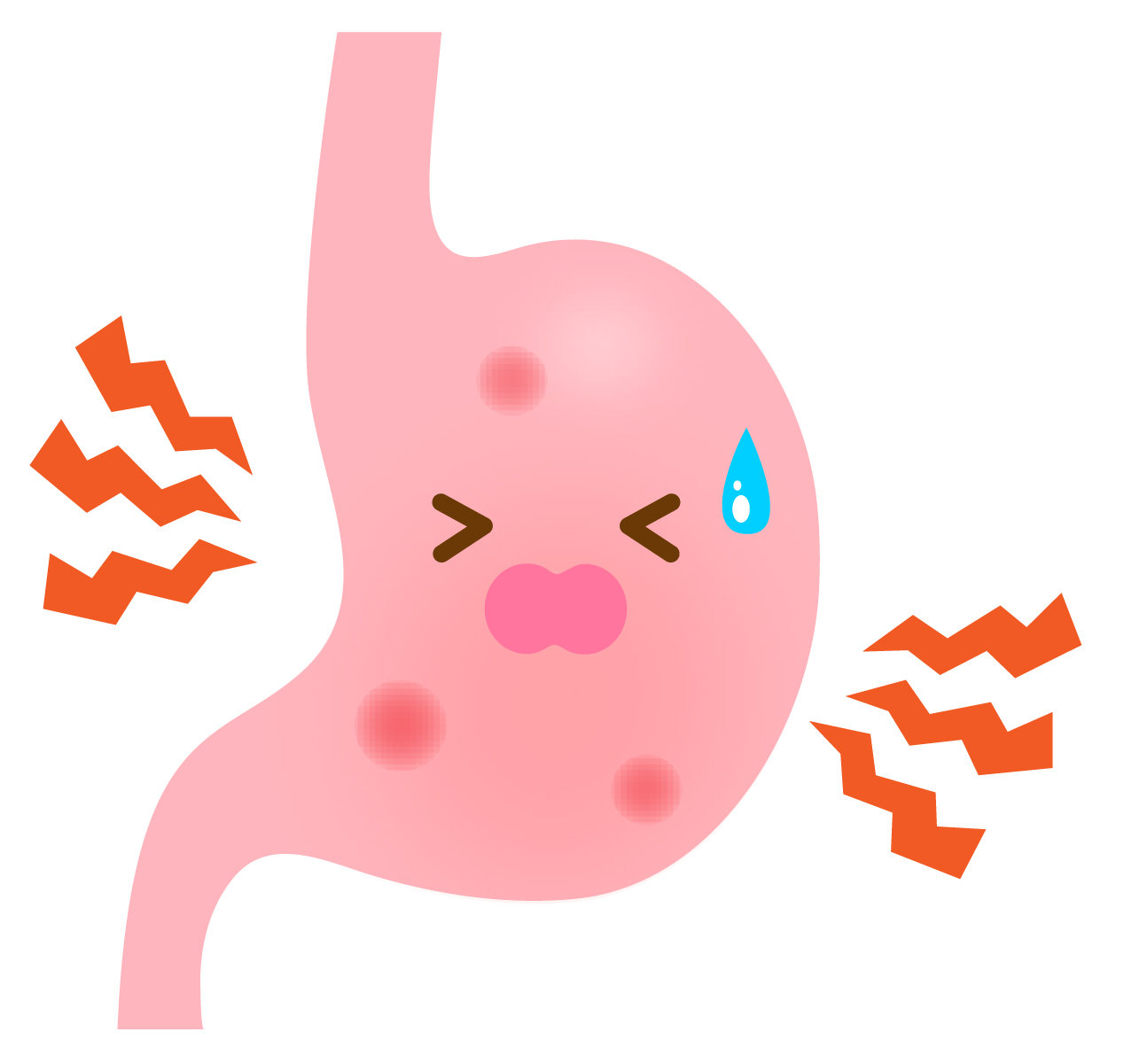 胃潰瘍について