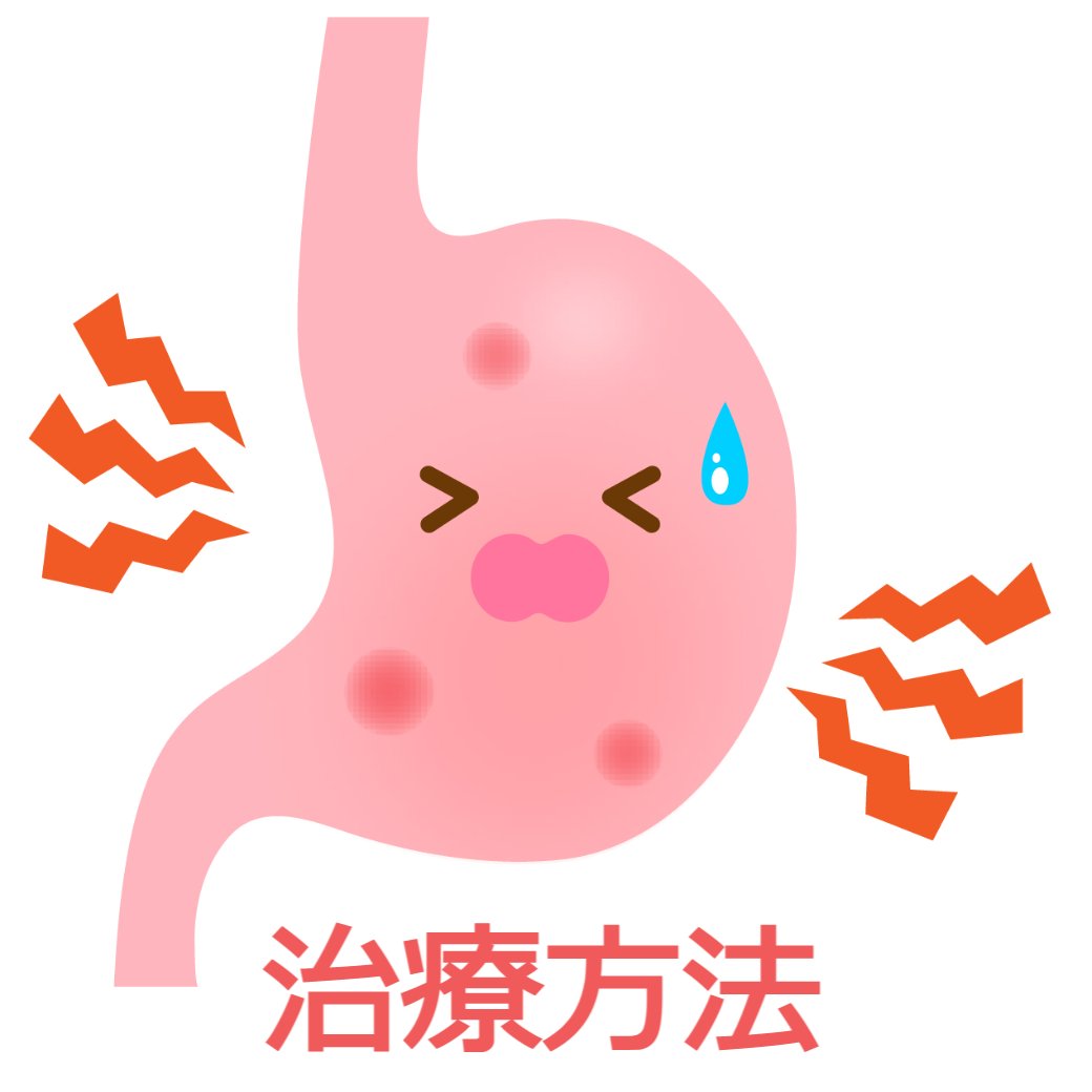 胃潰瘍『治療方法』