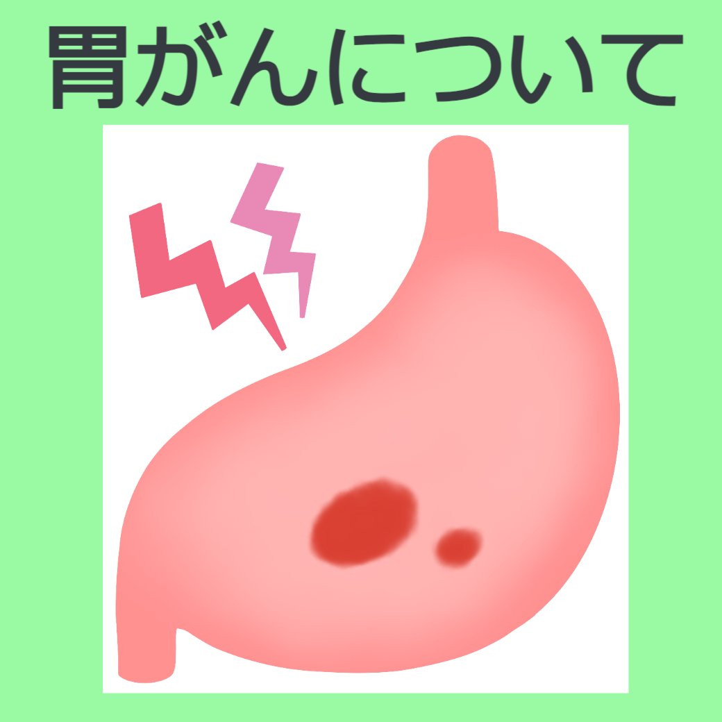 胃がんについて