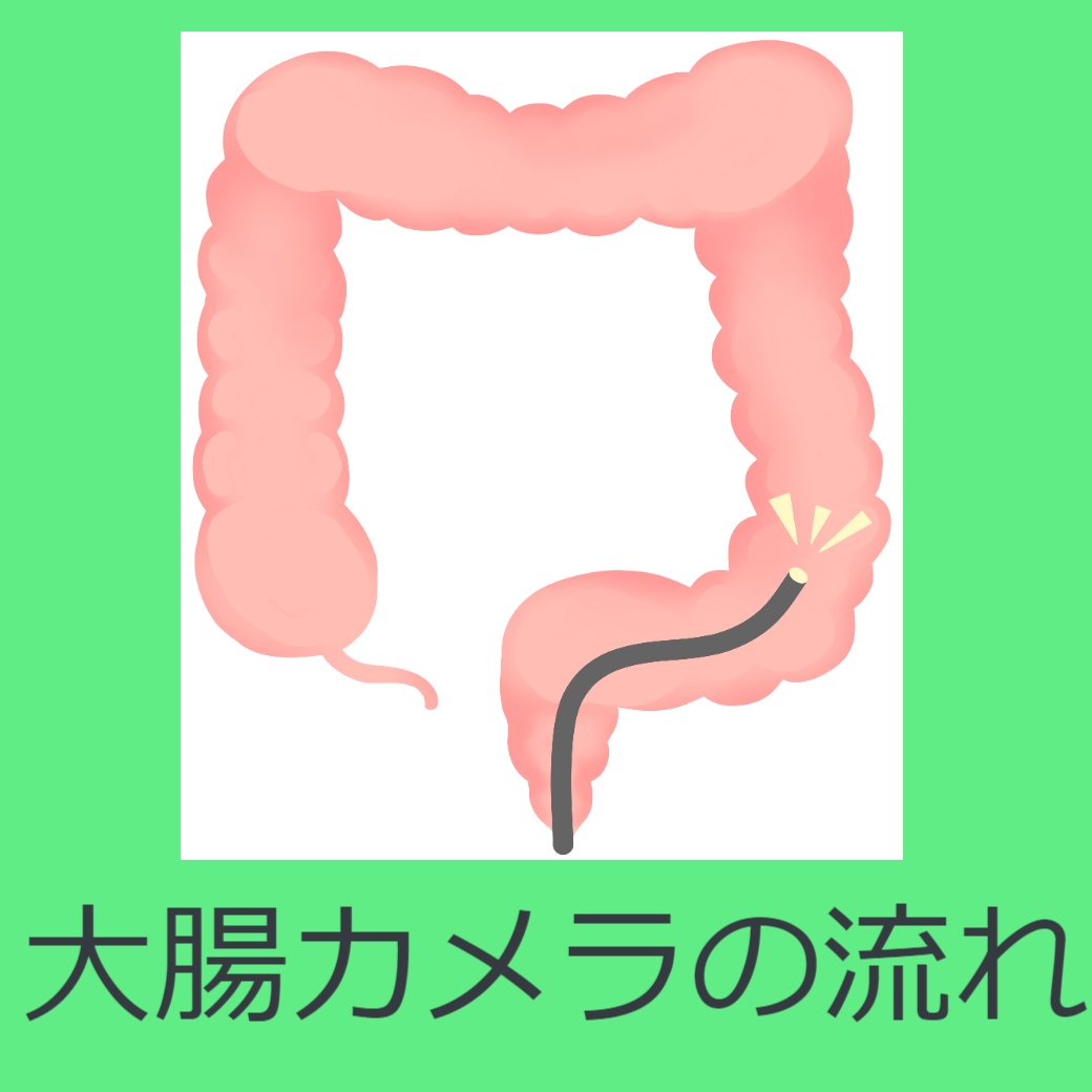 大腸カメラの流れ