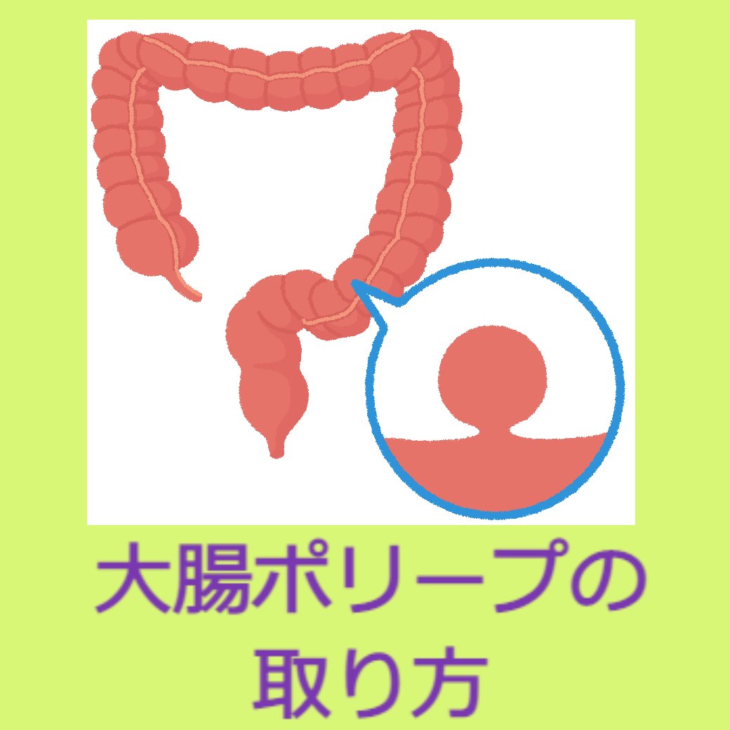 大腸ポリープの切除方法