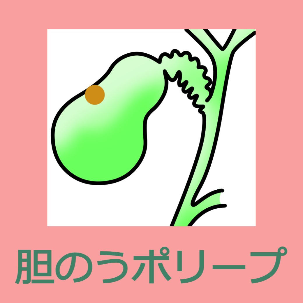 胆のうポリープについて