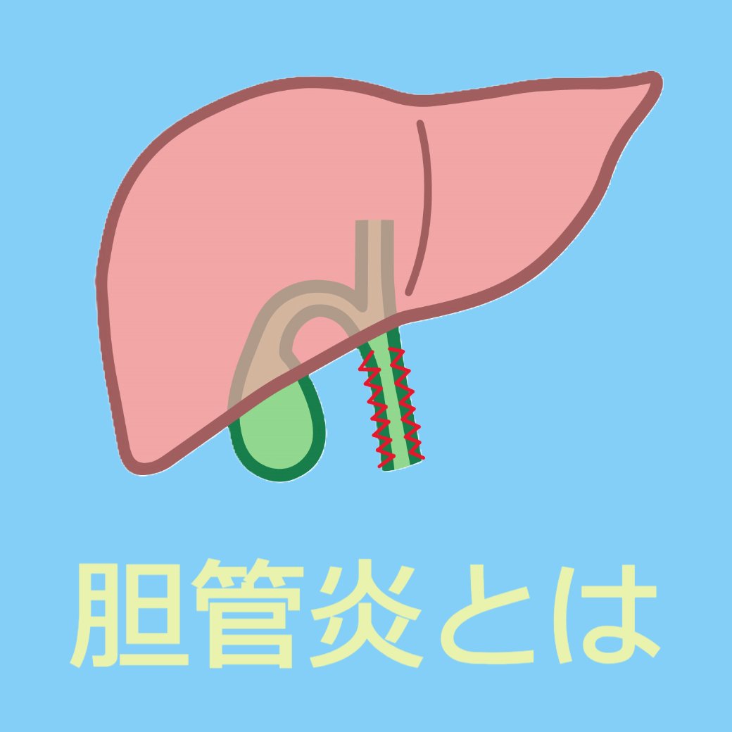 胆管炎とは