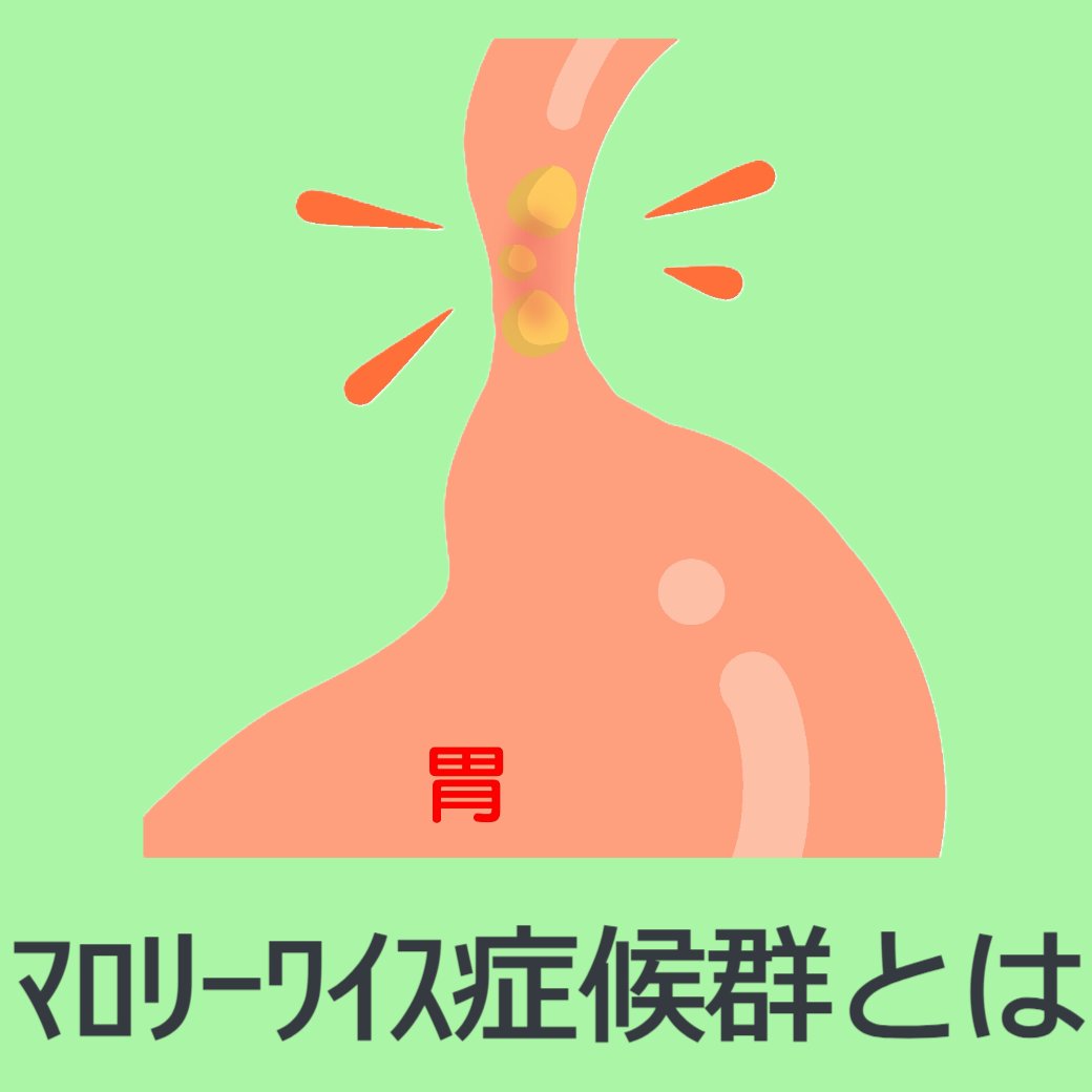 マロリーワイス症候群って？