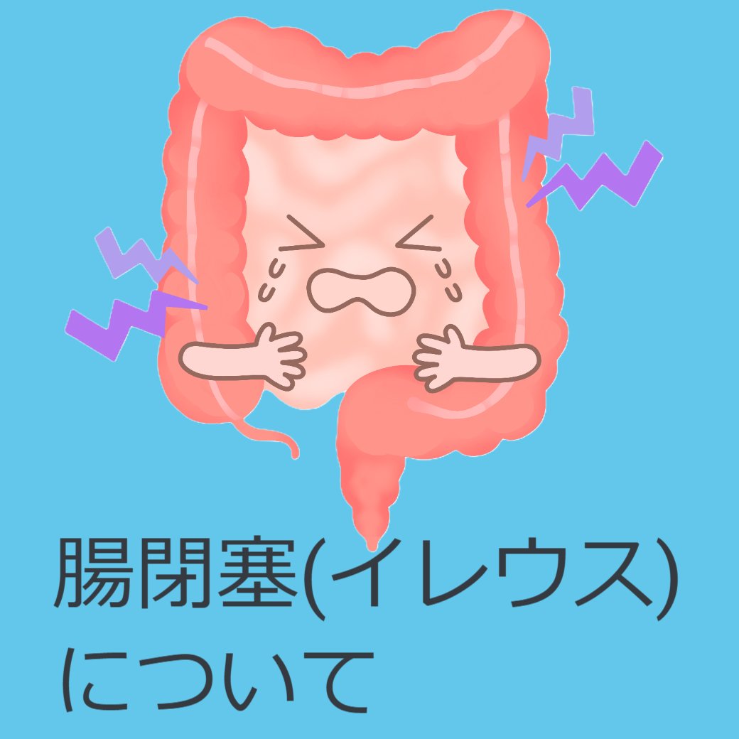 腸閉塞(イレウス)について