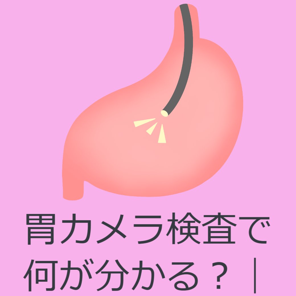 胃カメラ検査で何が分かる？